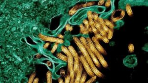 RDC : une nouvelle épidémie d’Ebola confirmée en Ituri, l’OMS renforce sa riposte